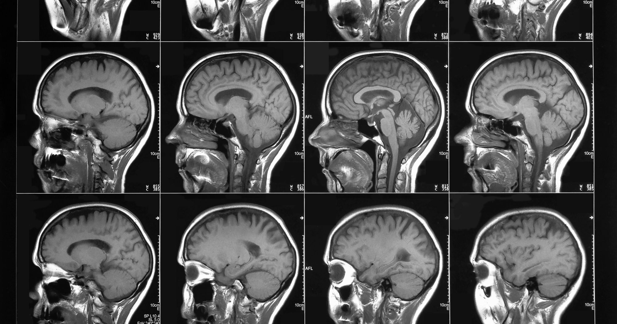 2000px x 1049px - Scientists Discover Brain Structure Differences in Frequent ...