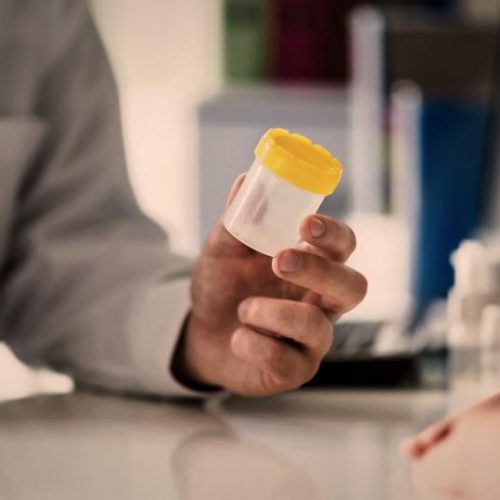 testing-stds-stis-porn-industry-porn-kills-love-doctor-pee-cup