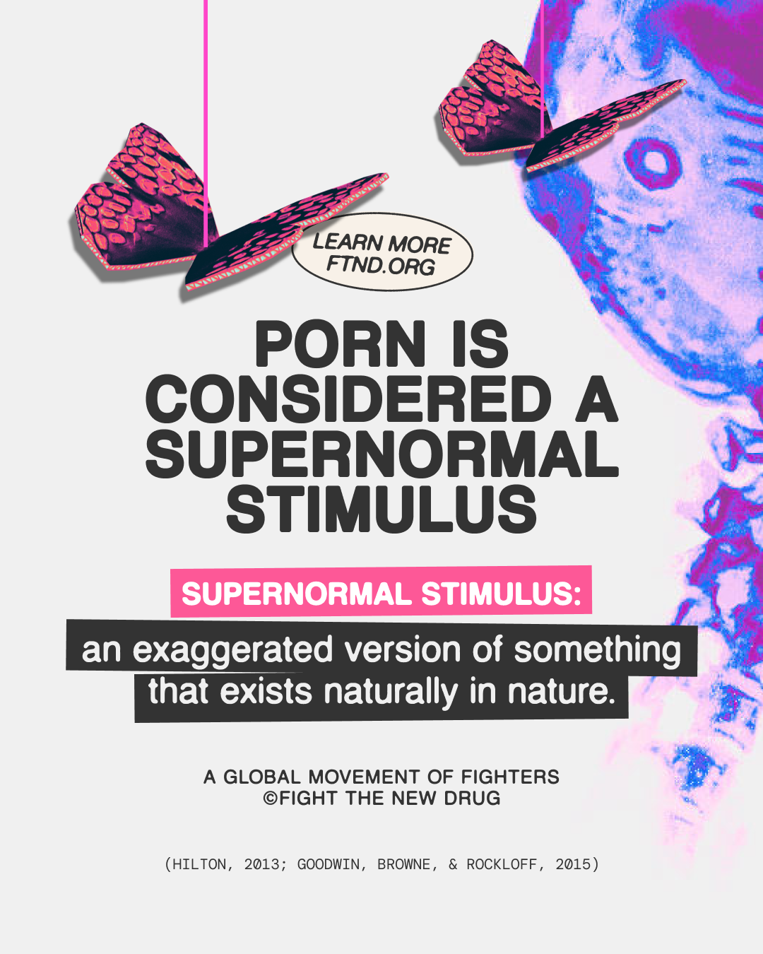FTND_Supernormal